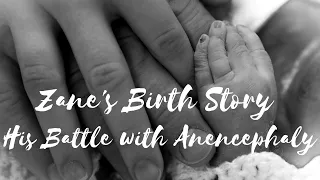 Chelsea's Birth Story-Zane's battle with Anencephaly. **Trigger Warning-Stillbirth**
