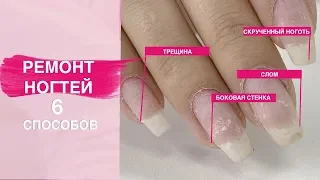 How to fix a broken nail? NAIL REPARE in six ways