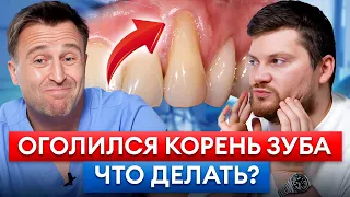 Что делать, если шейка зуба ОГОЛИЛАСЬ? 8 факторов рецессии десны