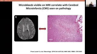 Grand Rounds- CAA & Vascular Cognitive Impairment- Dr. Anand Viswanathan, Harvard Medical School