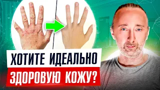 Высыпания на коже? Устраните псориаз, экзему, дерматит ФУЛЬВОВОЙ кислотой с В9!