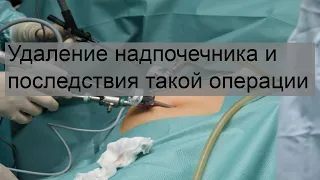 Удаление надпочечника и последствия такой операции