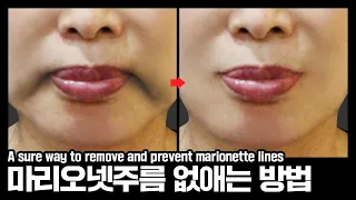 [Eng] 마리오넷주름 확실한 예방법!! / 입꼬리 처짐 / 불독살 / 심술보 / How to get rid of marionette wrinkles.