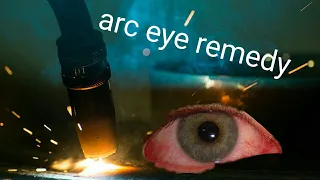 Arc eye remedy day 2