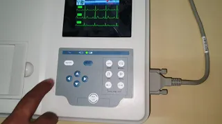 Eletrocardiografo COMEN CM300 1