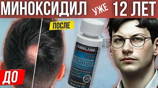 Еще помогает? | Миноксидил для волос | 12 лет использования миноксидила