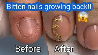 Bitten nails GROWING BACK! Amazing Transformation with Gel Overlay