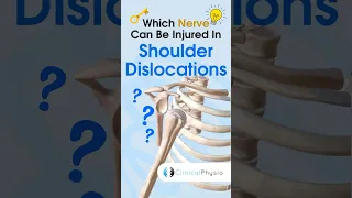 Anterior Shoulder Dislocations can affect which nerve? #physicaltherapy #physiotheraphy #anatomy