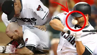 MLB// Worst Hit By Pitch• Part1