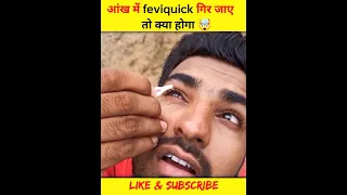 😱आंख के Feviquick गिर जाए तो क्या होगा 🤯 #youtubeshorts #ytshorts #trending #shorts #feviquick