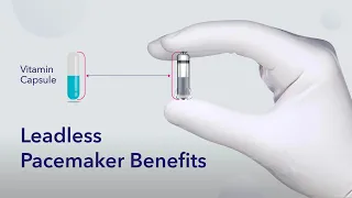 Benefits Of Leadless Pacemakers