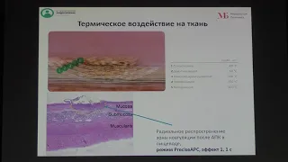 37 Антипова МВ Эффективность Аргоно плазменной коагуляции в лечении желудочно кишечных кровотечений