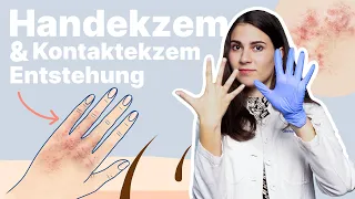 Hände trocken und rissig - was tun? Ärztin erklärt! 👋