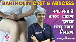 Bartholin Cyst & Abscess in Hindi - बार्थोलिन सिस्ट क्या होता है, कारण, लक्षण, इलाज और घरेलू उपाय