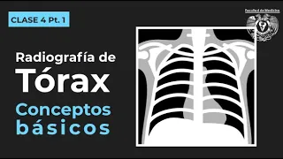 04.1 - Tórax - Radiografía de tórax normal