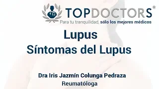 Lupus ¿Cuáles son los síntomas del lupus?