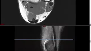 Ankle MRI (Approach to MSK MRI Series)