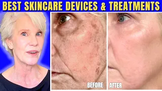 Best Skincare Treatments to Transform Mature Skin (Top 3 Devices & Top 3 In-Office Treatments)