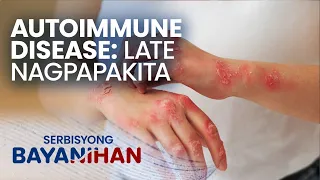 Ano ang autoimmune disease?