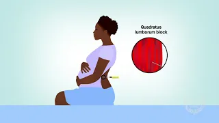 Quadratus lumborum block for cesarean delivery