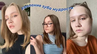 удаление зуба мудрости // мой опыт