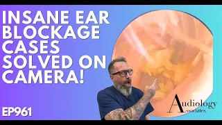 INSANE EAR WAX BLOCKAGES SOLVED ON CAMERA - EP961