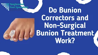 Do Bunion Correctors and Non-Surgical Bunion Treatment Work?