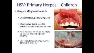 Human Herpes Virus Infections