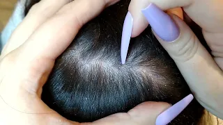 SCALP SCRATCHING, Dandruff Removal, No talking ASMR.