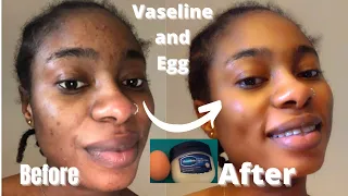 No Jokes! Vaseline and Egg! Transforms your face in one day | Anti Aging secret