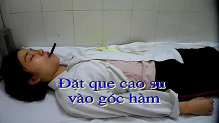 SỐC ĐIỆN TIỀN MÊ