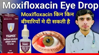 Moxifloxacin Eye drops | Moxifloxacin eye drop uses in hindi | Vigamox | Mahaflox | Moxifloxacin