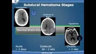 Traumatic Brain Injury Part 2