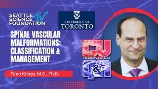 Spinal Vascular Malformations:  Classification & Management - Timo Krings, MD, PhD