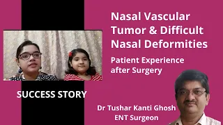 Nasal Tumor Surgery in Kolkata. Nasal Deformity Treatment. Patient Experience - Dr T K Ghosh