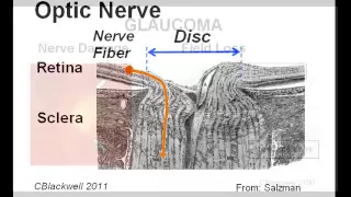 Eye Works 2: Image: Retina, Optic Nerve and Brain