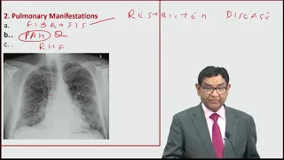 MRCP  | Systemic Sclerosis | Lectures by Dr Bhatia