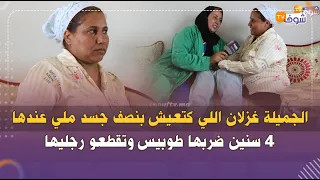 ميمكنش متبكيش...الجميلة غزلان اللي كتعيش بنصف جسد ملي عندها 4 سنين ضربها طوبيس وتقطعو رجليها