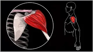 Sore shoulder. Deltoid muscle: anatomy, functions, trigger points, exercises