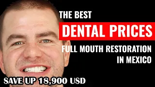 Full Mouth Reconstruction Cost in Mexico