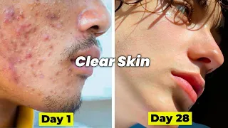 How to get clear skin in 28 days | Glowing skin