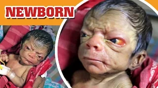A Newborn Baby Who Looks Like An 80 Years Old [SHOCKING R]