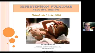 Hipertensión Pulmonar, estado del arte - Dr. Hector Romero