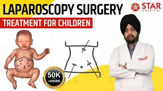 Laparoscopic Surgery in Child | Key Hole Surgery in Kids Laser Surgery Children | Advantages Problem