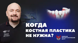 Когда можно обойтись без костной пластики