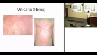 FYI: Pediatric Rashes