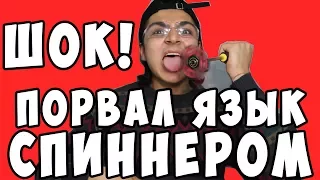 ШОК! ПАРЕНЬ ПОРВАЛ ЯЗЫК СПИННЕРОМ! СМОТРИ ЧТО БЫЛО ДАЛЬШЕ