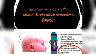 Wolf - Hirschhorn Syndrome (WHS) (In English)