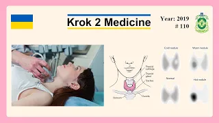 [ Krok 2 Medicine ] Year: 2019 - 110 (Ministry of Public Health of Ukraine)