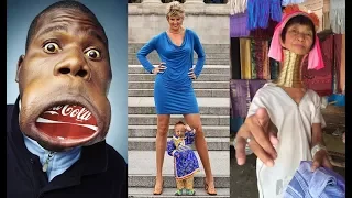 Top 10 People With The Largest Human Body Parts 2018